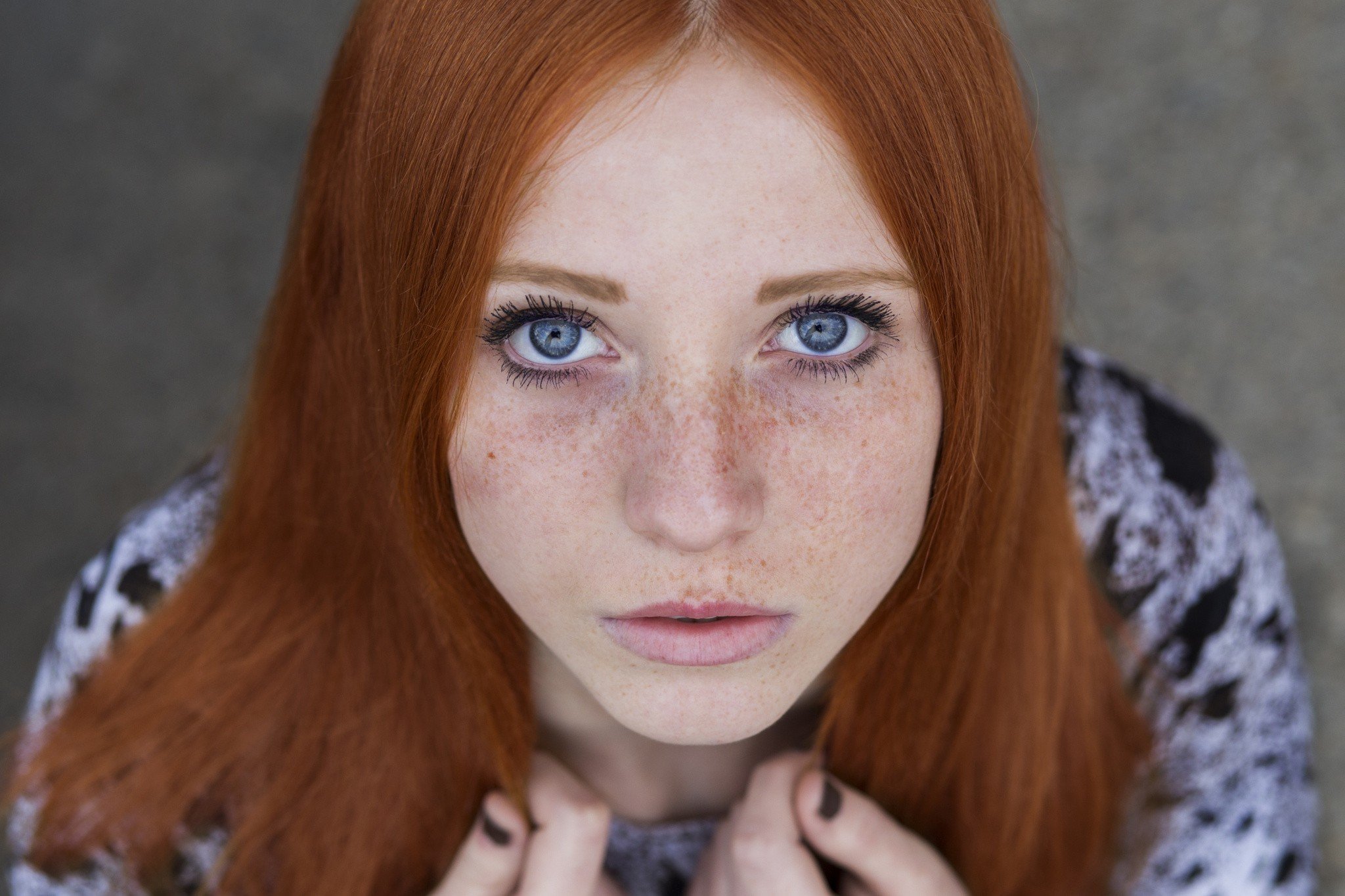 Can Redheads Get Laser Hair Removal?