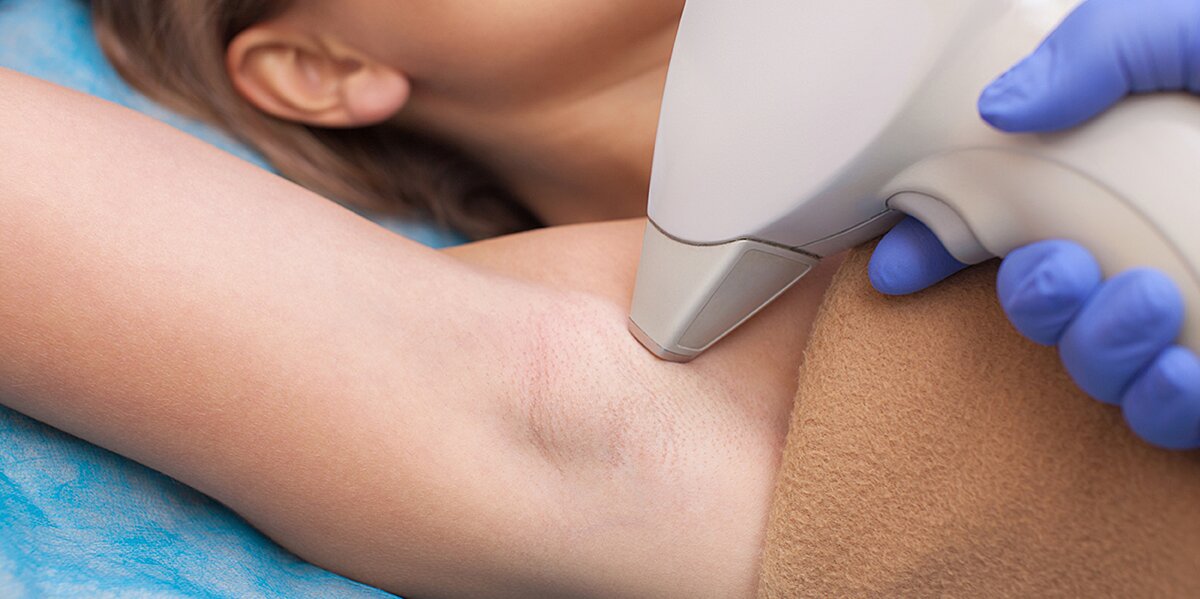 Does Laser Hair Removal Work on Blonde Hair?