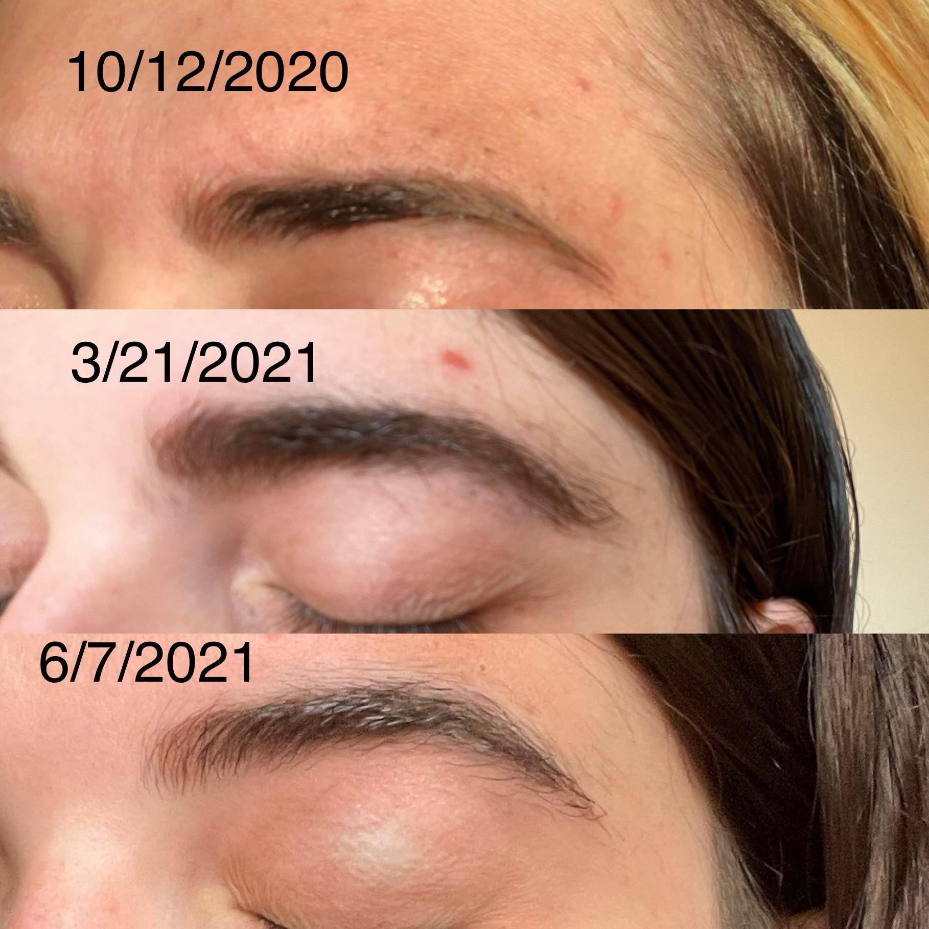 Will Microblading Fade Completely?
