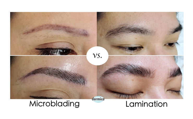 Can You Laminate Microbladed Brows?
